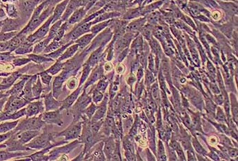 小鼠肝星状细胞(永生化细胞) Immortalization of mouse hepatic stellate cells