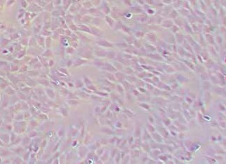 小鼠骨髓巨噬细胞(永生化细胞) Immortalization of mouse bone marrow macrophages
