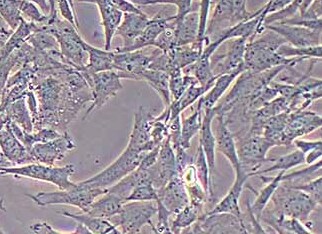 小鼠肺成纤维细胞(永生化细胞） Mouse lung fibroblasts (immortalized)