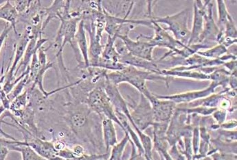 小鼠骨髓间充质干细胞(永生化细胞) Immortalization of Mouse Bone Marrow Mesenchymal Stem Cells - Large T