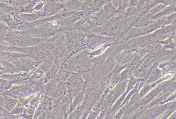 小鼠角膜上皮细胞永生化小鼠角膜上皮细胞(永生化细胞） Mouse corneal epithelial cells (immortalized)