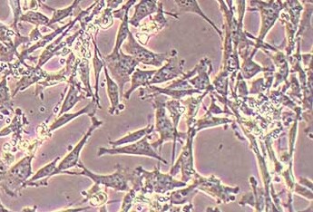 小鼠结肠粘膜上皮细胞(永生化细胞） Immortalization of mouse colonic mucosal epithelial cells