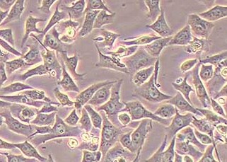 B16F10-PLV-LUC-PURO小鼠黑色素瘤细胞（荧光示踪细胞）+luc B16F10-PLV-LUC-PURO mouse melanoma+luc