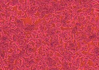 CT26+LUC小鼠结肠癌细胞（荧光示踪细胞）+LUC CT26+LUC mouse colon cancer cells+LUC