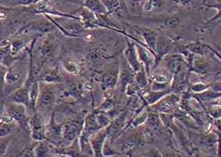 ID8-LUC小鼠卵巢上皮癌细胞（荧光示踪细胞）+LUC ID8-LUC mouse ovarian epithelial cancer cells+LUC