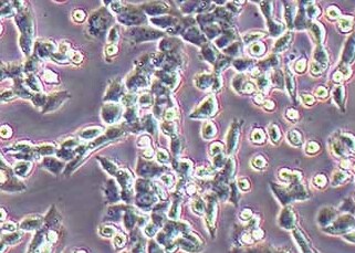 llc-GFP-puro小鼠Lewis肺癌细胞(荧光示踪细胞)+gfp LLC GFP puro mouse Lewis lung cancer cells+gfp