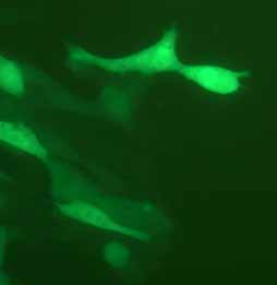 4T1-LUC-EGFP小鼠乳腺癌细胞(荧光示踪细胞) 4T1-LUC-EGFP mouse breast cancer cells