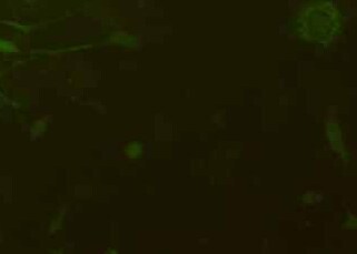 K7M2 WT -GFP-PURO小鼠骨肉瘤成骨细胞(荧光示踪细胞)+LUC K7M2 WT-GFP-PURO mouse osteosarcoma osteoblasts+LUC