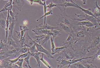 大鼠内皮祖细胞永生化 Immortalization of rat endothelial progenitor cells