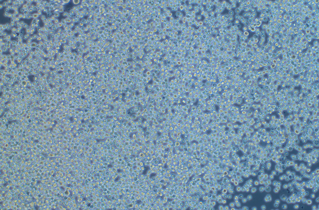 LLC-WRC 256 [Walker 256] (大鼠腹水癌细胞系) LLC-WRC 256 [Walker 256] (rat ascites cancer cells)