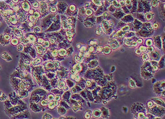 MMQ (大鼠垂体瘤细胞系) (种属鉴定正确) MMQ (rat pituitary tumor cells)