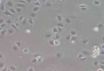 IEC-6大鼠小肠隐窝上皮细胞系 IEC-6 rat intestinal crypt epithelial cells