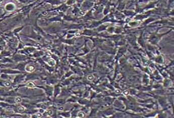 C6 (大鼠胶质瘤细胞系) (种属鉴定正确) C6 (rat glioma cells)