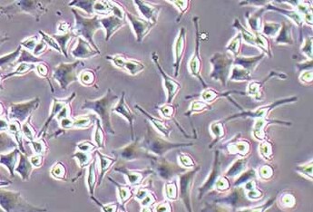 RIN-m5F (大鼠胰岛β细胞瘤细胞系) Rat β islet tumor cells