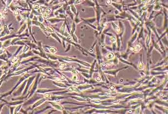 PC-12(大鼠肾上腺嗜铬细胞瘤细胞系(高分化)) (种属鉴定正确) PC12