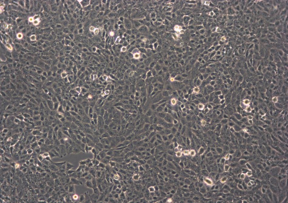 UMR-106 (大鼠骨肉瘤细胞系) (种属鉴定正确) UMR-106 (rat osteosarcoma cells) (species identification correct)