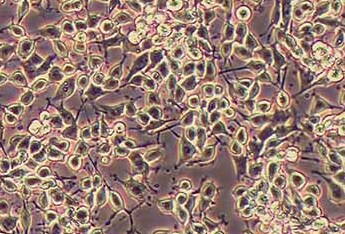 MADB106大鼠乳腺癌细胞系 MADB106 rat breast cancer cells