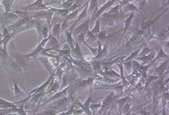 rRTEC大鼠肾小管上皮细胞系 RRTEC rat renal tubular epithelial cells