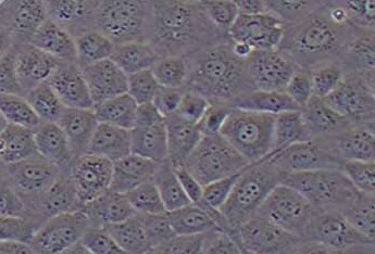 NRK-52E (大鼠肾细胞系) (种属鉴定正确) NRK-52E (rat kidney cells) (species identification correct)