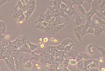 CBRH7919大鼠肝癌细胞系 CBRH7919 rat liver cancer cells
