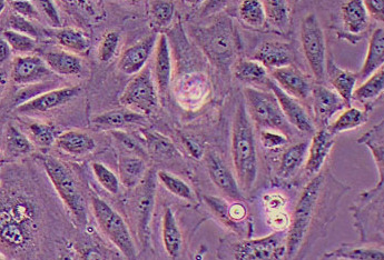 H9C2大鼠心肌细胞系 H9c2 rat cardiomyocytes H9c2 (2-1); H9c2