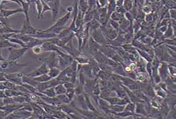 HSC-T6大鼠肝储脂细胞(永生化细胞) HSC-T6 immortalized rat hepatic adipocytes